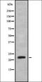 G Protein-Coupled Receptor 61 antibody, orb335620, Biorbyt, Western Blot image 