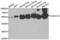 Aldehyde Dehydrogenase 1 Family Member A2 antibody, LS-C349196, Lifespan Biosciences, Western Blot image 