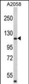 Rho GTPase Activating Protein 45 antibody, PA5-49605, Invitrogen Antibodies, Western Blot image 