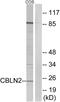 Cerebellin 2 Precursor antibody, GTX87797, GeneTex, Western Blot image 