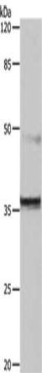 Cyclin Dependent Kinase 6 antibody, CSB-PA871419, Cusabio, Western Blot image 