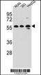 Tripartite Motif Containing 4 antibody, 56-971, ProSci, Western Blot image 