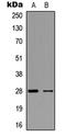 Fibroblast Growth Factor 23 antibody, LS-C356035, Lifespan Biosciences, Western Blot image 