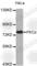 Protein Kinase C Zeta antibody, A5714, ABclonal Technology, Western Blot image 