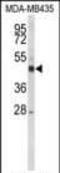 Cytochrome P450 Family 21 Subfamily A Member 2 antibody, PA5-26003, Invitrogen Antibodies, Western Blot image 