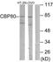 Nuclear Cap Binding Protein Subunit 1 antibody, LS-C118997, Lifespan Biosciences, Western Blot image 
