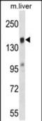 T Cell Lymphoma Invasion And Metastasis 2 antibody, PA5-48604, Invitrogen Antibodies, Western Blot image 