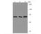 Ectonucleoside Triphosphate Diphosphohydrolase 1 antibody, A03196-2, Boster Biological Technology, Western Blot image 