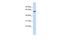 Zinc Finger Protein 207 antibody, A10807, Boster Biological Technology, Western Blot image 