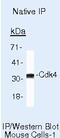 Cyclin D2 antibody, AHF0112, Invitrogen Antibodies, Immunoprecipitation image 
