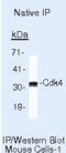 Cyclin D2 antibody, AHF0112, Invitrogen Antibodies, Immunoprecipitation image 