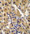 Ectonucleotide Pyrophosphatase/Phosphodiesterase 2 antibody, abx031746, Abbexa, Flow Cytometry image 