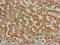 Insulin Receptor antibody, LS-C678359, Lifespan Biosciences, Immunohistochemistry paraffin image 