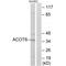 Acyl-CoA Thioesterase 8 antibody, A09392, Boster Biological Technology, Western Blot image 
