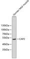 Cyclase Associated Actin Cytoskeleton Regulatory Protein 2 antibody, 18-762, ProSci, Western Blot image 