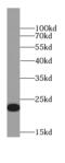 Gastrokine-1 antibody, FNab03473, FineTest, Western Blot image 