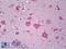 Par-3 Family Cell Polarity Regulator antibody, LS-B6786, Lifespan Biosciences, Immunohistochemistry paraffin image 