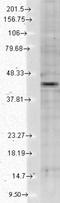 Potassium Voltage-Gated Channel Subfamily J Member 12 antibody, NBP2-12901, Novus Biologicals, Western Blot image 