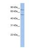 T-Complex-Associated-Testis-Expressed 1 antibody, NBP1-56639, Novus Biologicals, Western Blot image 