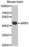 Arrestin-C antibody, STJ22691, St John