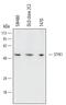 Serine/Threonine/Tyrosine Kinase 1 antibody, MAB6668, R&D Systems, Western Blot image 