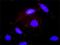 Adenylate Cyclase 2 antibody, H00000108-M01, Novus Biologicals, Western Blot image 