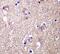 TYRO3 Protein Tyrosine Kinase antibody, ab109231, Abcam, Immunohistochemistry paraffin image 