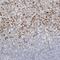 Fibroleukin antibody, NBP1-87199, Novus Biologicals, Immunohistochemistry paraffin image 
