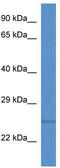 Transmembrane P24 Trafficking Protein 1 antibody, TA341868, Origene, Western Blot image 