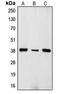 T Cell Receptor Beta Constant 1 antibody, MBS821354, MyBioSource, Western Blot image 