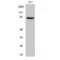 Junction Plakoglobin antibody, LS-C382464, Lifespan Biosciences, Western Blot image 