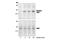 P21 (RAC1) Activated Kinase 3 antibody, 2601S, Cell Signaling Technology, Western Blot image 