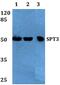 Protein SPT3 antibody, PA5-36134, Invitrogen Antibodies, Western Blot image 