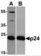 HIV-1 gp24 antibody, NBP2-41336, Novus Biologicals, Western Blot image 