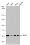 Elongator Acetyltransferase Complex Subunit 3 antibody, GTX631395, GeneTex, Western Blot image 