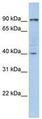Glycogen Phosphorylase B antibody, TA346713, Origene, Western Blot image 