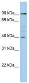 Glycogen phosphorylase, brain form antibody, TA346713, Origene, Western Blot image 