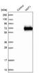 N-Myristoyltransferase 1 antibody, NBP1-82548, Novus Biologicals, Western Blot image 