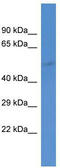 Gamma-Aminobutyric Acid Type A Receptor Alpha5 Subunit antibody, TA329169, Origene, Western Blot image 