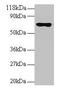 Ribosomal Protein L15 antibody, LS-C211622, Lifespan Biosciences, Western Blot image 