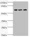 Piasx antibody, orb352927, Biorbyt, Western Blot image 