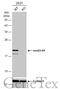NME/NM23 Nucleoside Diphosphate Kinase 1 antibody, GTX108325, GeneTex, Western Blot image 