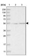 RNA Binding Motif Protein 17 antibody, NBP1-81202, Novus Biologicals, Western Blot image 