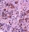 Selectin E antibody, orb10342, Biorbyt, Immunohistochemistry paraffin image 