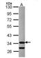 Cyclin Dependent Kinase 3 antibody, NBP1-32230, Novus Biologicals, Western Blot image 