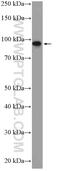 Progesterone Immunomodulatory Binding Factor 1 antibody, 14413-1-AP, Proteintech Group, Western Blot image 