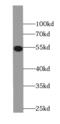 Calcium/Calmodulin Dependent Protein Kinase II Delta antibody, FNab01233, FineTest, Western Blot image 