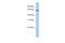 Adenosylhomocysteinase Like 1 antibody, 25-118, ProSci, Enzyme Linked Immunosorbent Assay image 