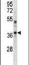 PDZ Binding Kinase antibody, PA5-13968, Invitrogen Antibodies, Western Blot image 