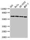 Netrin 1 antibody, LS-C675136, Lifespan Biosciences, Western Blot image 